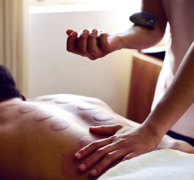 Cupping massage being done to the back