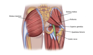 Sciatica Piriformis Syndrome Massage